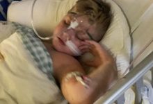Фото - Юный пациент несколько лет страдал не от астмы, а от застрявшей в горле пластиковой игрушки